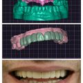 Bridging Function & Esthetics with Digital Precision